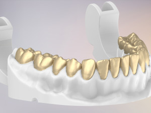 3D Dental Jaws Replica with Detachable Teeth Modèles 3D en vedette