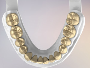 3D Dental Jaws Replica with Detachable Teeth Modèles 3D en vedette