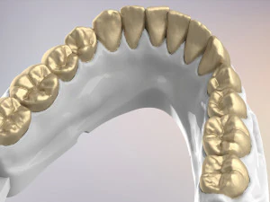 3D Dental Jaws Replica with Detachable Teeth 3D Print Model