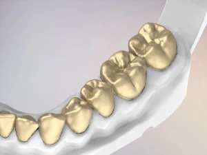 3D Dental Jaws Replica with Detachable Teeth 3D Print Model