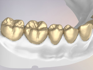 3D Dental Jaws Replica with Detachable Teeth Modèles 3D en vedette