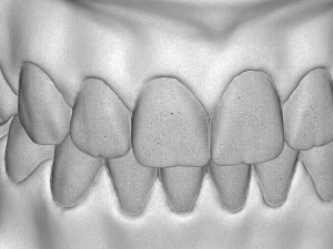 3D Dental Jaws Replica with Detachable Teeth Modèles 3D en vedette