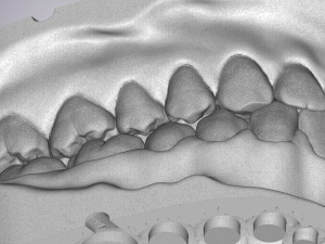 3D Dental Jaws Replica with Detachable Teeth Modèles 3D en vedette