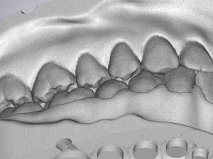 3D Dental Jaws Replica with Detachable Teeth 3D Print Model