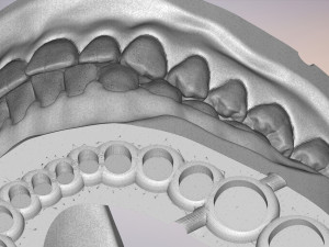 3D Dental Jaws Replica with Detachable Teeth Modèles 3D en vedette