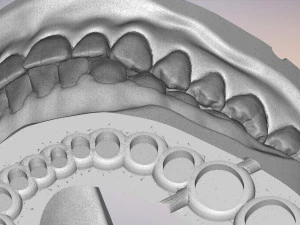 3D Dental Jaws Replica with Detachable Teeth 3D Print Model