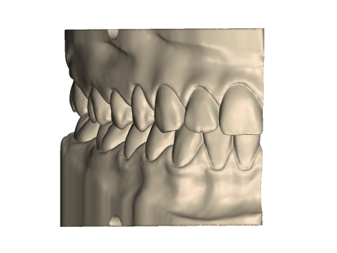Dental Practice Model Kit 3D Print Model