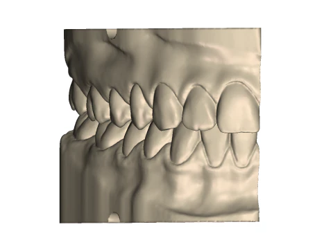 Dental Practice Model Kit 3D Print Model
