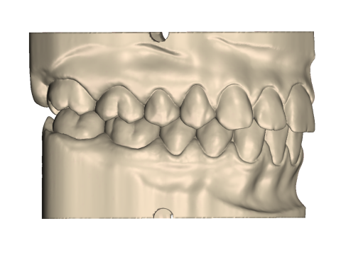 Dental Practice Model Kit 3D Print Model
