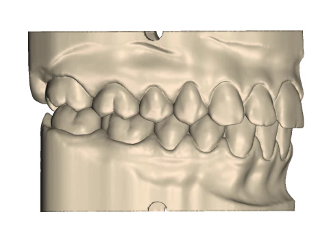 Dental Practice Model Kit 3D Print Model