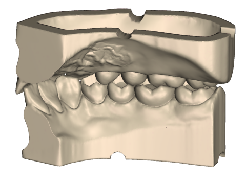 Dental Practice Model Kit 3D Print Model