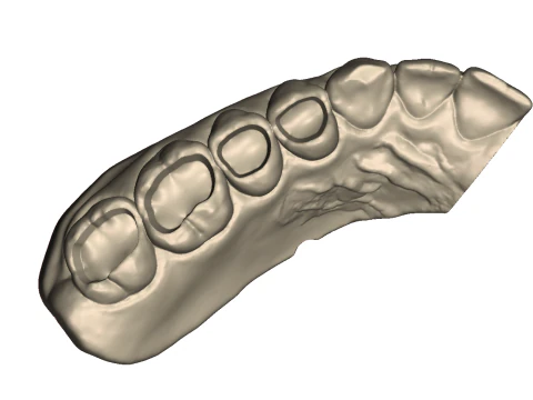 Dental Practice Model Kit 3D Print Model