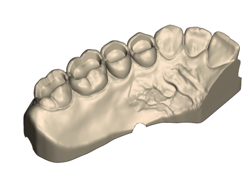 Dental Practice Model Kit 3D Print Model