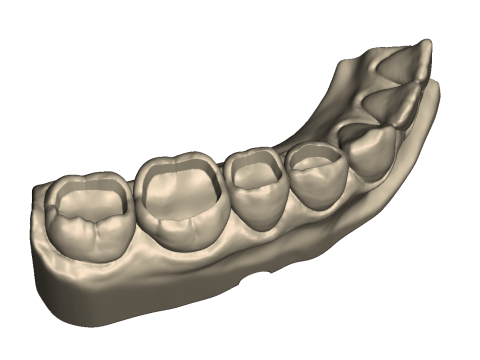 Dental Practice Model Kit 3D Print Model