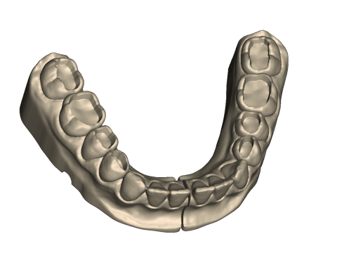 Dental Practice Model Kit 3D Print Model
