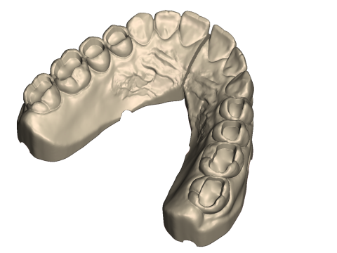 Dental Practice Model Kit 3D Print Model