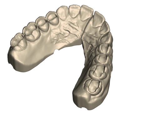 Dental Practice Model Kit 3D Print Model