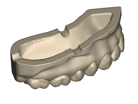 Dental Practice Model Kit 3D Print Model