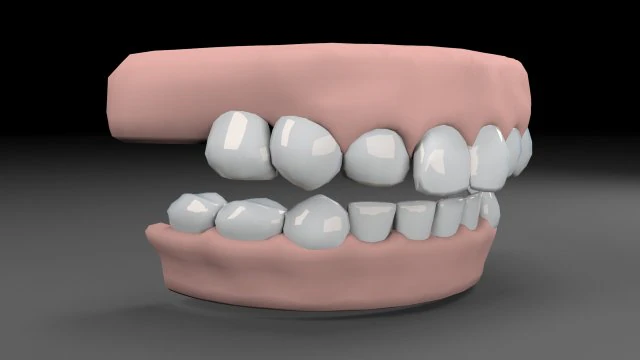 teeths 3D Model .c4d .max .obj .3ds .fbx .stl .blend