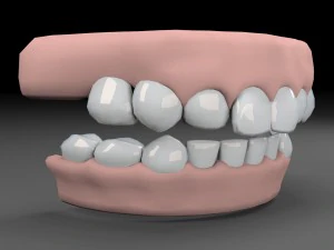 Z&auml;hne 3D Modell