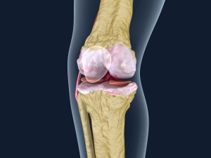 osteoporosis of the knee joint Modelo 3D