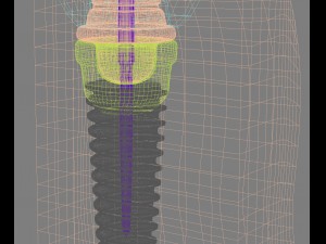 anatomy of healthy teeth and dental implant in jaw Model 3D