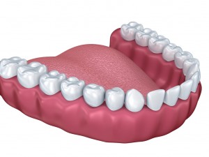 lower teeth crown and dental implant 3D Модель
