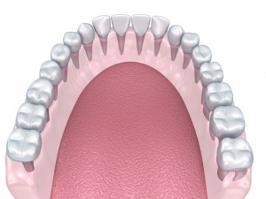lower teeth crown and dental implant 3D Модель