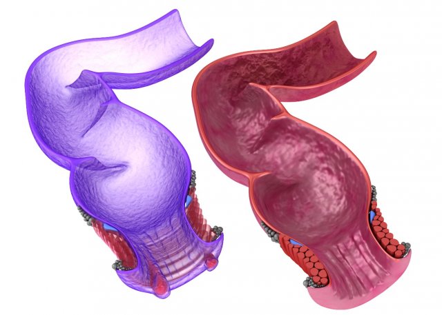 human anatomy rectum and hemorrhoids 3D Model .c4d .max .obj .3ds .fbx .stl .blend 