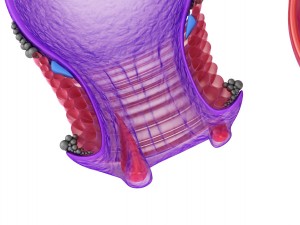 human anatomy rectum and hemorrhoids 3D Model