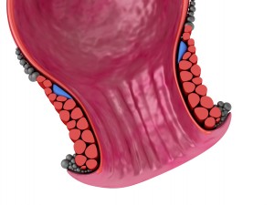 human anatomy rectum and hemorrhoids 3D Model