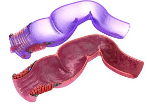human anatomy rectum and hemorrhoids 3D Model