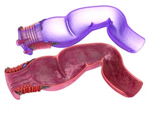 human anatomy rectum and hemorrhoids 3D Model