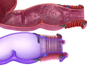 human anatomy rectum and hemorrhoids 3D Model