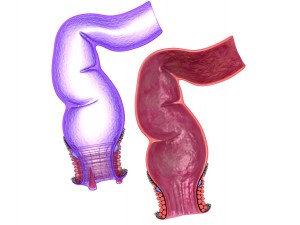 human anatomy rectum and hemorrhoids 3D Model