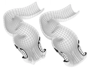 human anatomy rectum and hemorrhoids 3D Model