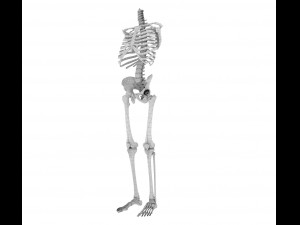 hip replacement implant installed in the pelvis bone 3D Model