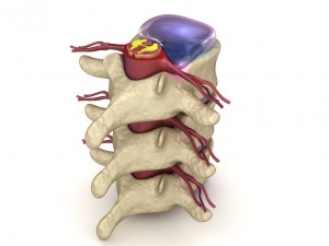 hernaited disc in human spine in details 3D मॉडल