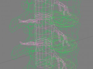 hernaited disc in human spine in details 3D मॉडल
