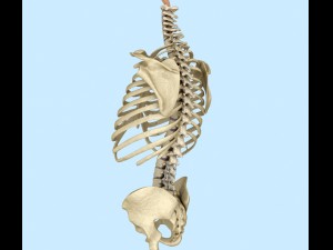 spinal fixation system - titanium bracket 3D 모델