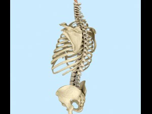 spinal fixation system - titanium bracket 3D Model