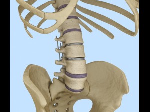 spinal fixation system - titanium bracket 3D 모델