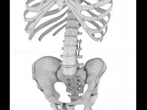 spinal fixation system - titanium bracket 3D 모델