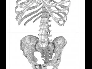 spinal fixation system - titanium bracket 3D Model