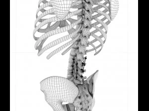 spinal fixation system - titanium bracket 3D Model