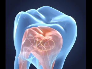 transparent tooth of endodontics inner structure 3D Model
