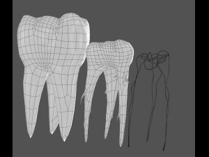transparent tooth of endodontics inner structure Modelo 3D