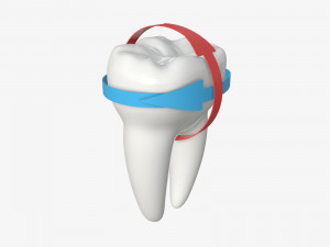 tooth molars with arrows 01 Model 3D
