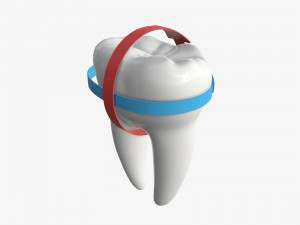 tooth molars with arrows 01 Model 3D