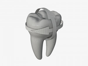 tooth molars with arrows 01 Model 3D